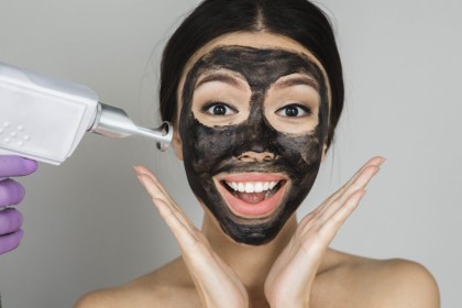 Carbon Laser Peel