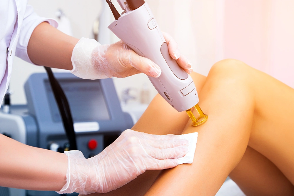 laser hair removal in bangalore