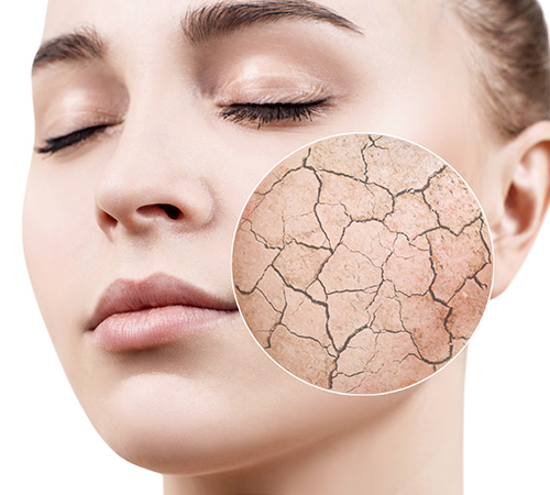 skin whitening laser treatment